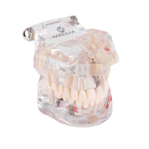 Arcada Dentaria Manequim Odontológico Macromodelo P Estudo e Demonstração