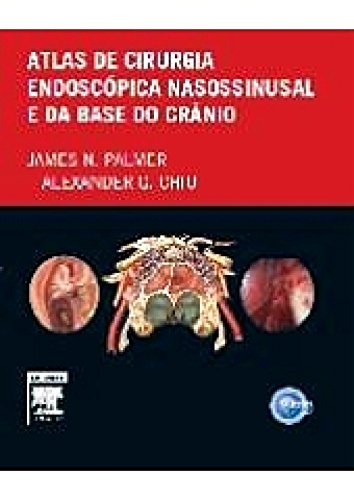 Atlas de Cirurgia Endoscópica Nanossinusal e da Base do Crânio