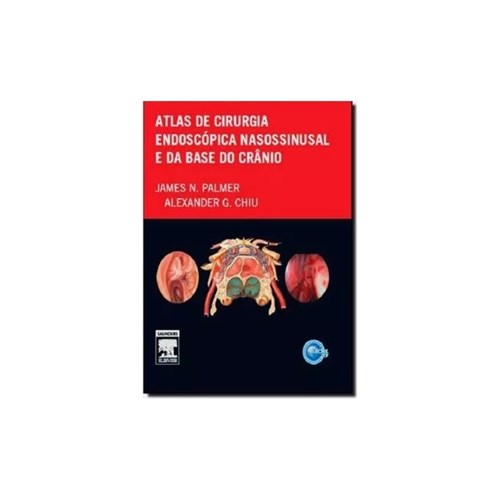 Atlas de Cirurgia Endoscópica Nasossinusal e da Base do Crânio