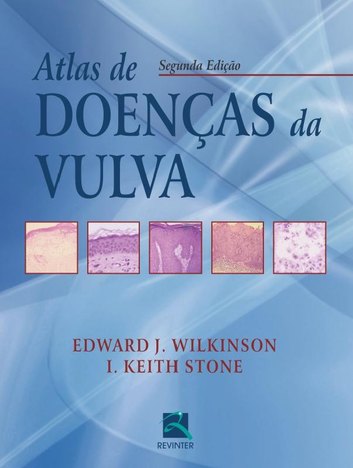 Atlas de Doencas da Vulva - 2ª Ed