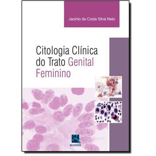 Tudo sobre 'Citologia Clinica do Trato Genital Feminino'