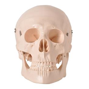 Crânio Humano Mandíbula e Calota Móvel e 3 Dentes Móveis