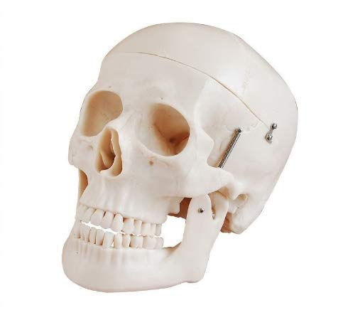 Crânio Humano Mandíbula e Calota Móvel e 3 Dentes Móveis