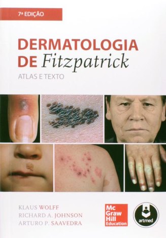Dermatologia de Fitzpatrick - 7º Ed