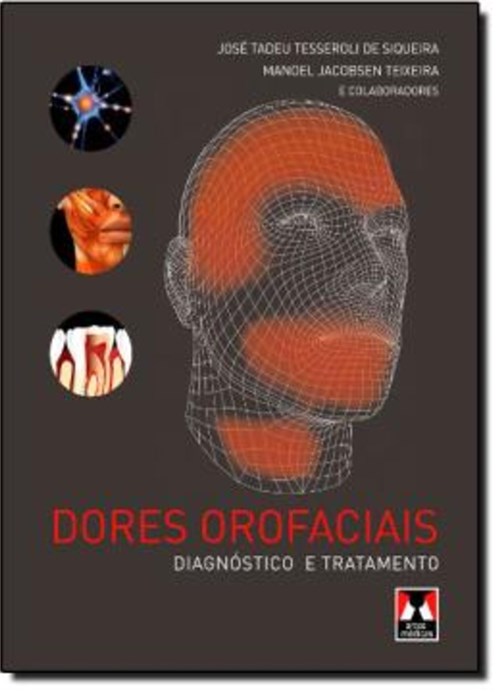 Dores Orofaciais - Diagnostico e Tratamento