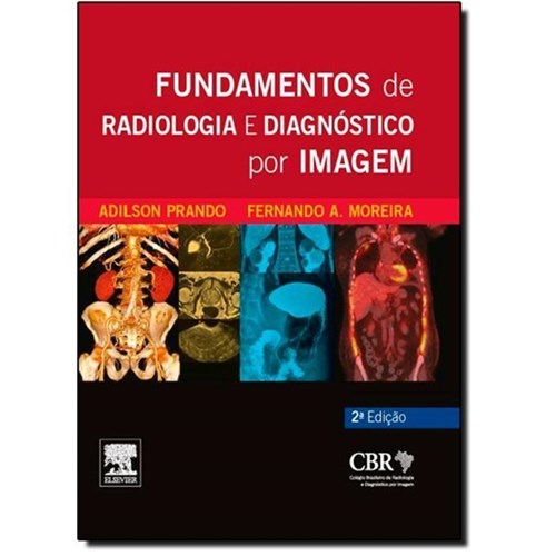 Fundamentos de Radiologia e Diagnóstico por Imagem 2ªedição