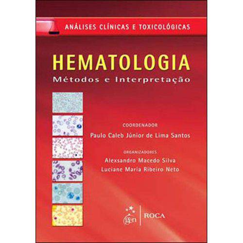 Tudo sobre 'Hematologia Clinica - Metodos e Interpretaçao'
