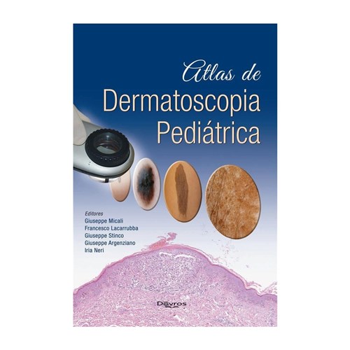 Livro - Atlas de Dermatoscopia Pediátrica - Micali