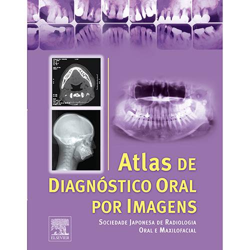 Tudo sobre 'Livro - Atlas de Diagnóstico Oral por Imagens'