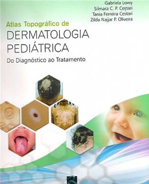 Livro - Atlas Topográfico de Dermatologia Pediátrica - Lowy