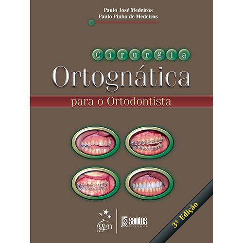 Tudo sobre 'Livro - Cirurgia Ortognática para o Ortodontista'