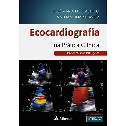 Tudo sobre 'Livro - Ecocardiografia na Prática Clínica - Problemas e Soluções'