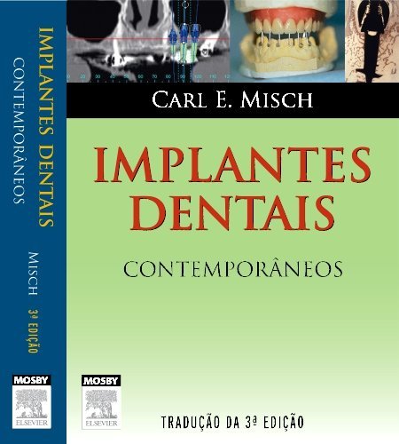 Livro - Implantes Dentais Contemporâneos