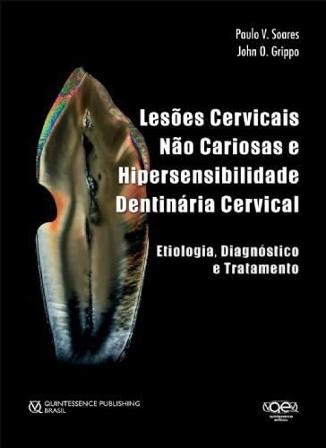 Livro Lesões Cervicais não Cariosas e Hipersensibilidade - Quintessence