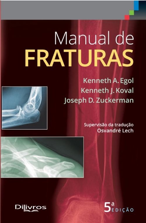 Livro - Manual de Fraturas - Koval