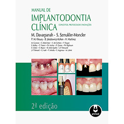 Tudo sobre 'Livro - Manual de Implantodontia Clinica: Conceitos, Protocolos e Inovações'