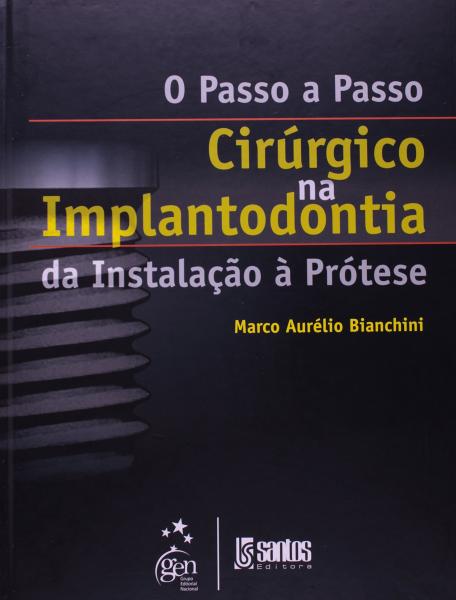 Livro - o Passo a Passo Cirúrgico na Implantodontia da Instalação à Prótese - Bianchini - Santos
