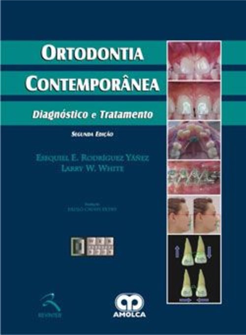 Livro - Ortodontia Contemporânea - Diagnóstico e Tratamento - Yanez