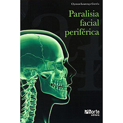 Tudo sobre 'Livro - Paralisia Facial Periférica'
