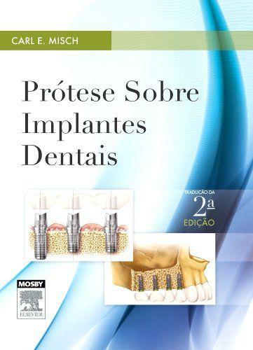Livro - Prótese Sobre Implantes Dentais