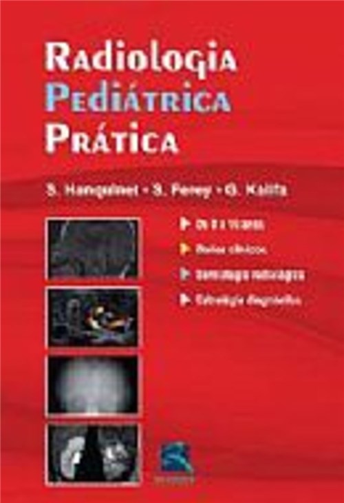 Tudo sobre 'Livro - Radiologia Pediátrica Prática - Hanquinet'