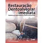 Tudo sobre 'Livro - Restauração Dentoalveolar Imediata - Implantes com Carga Imediata em Alvéolos Comprometidos'