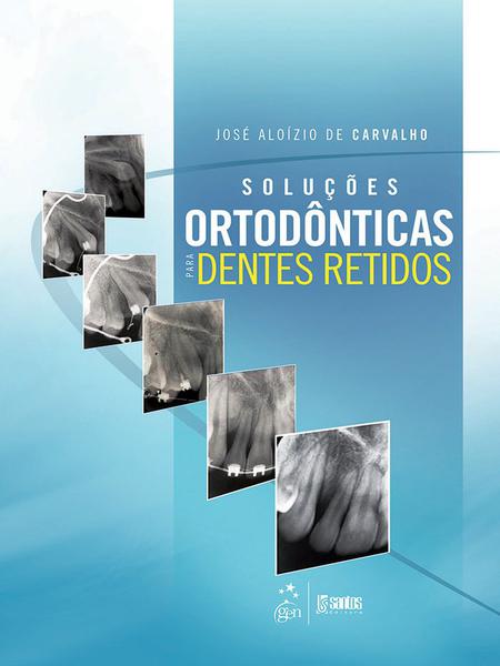 Livro - Soluções Ortodônticas para Dentes Retidos