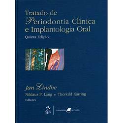 Tudo sobre 'Livro - Tratado de Periodontia Clínica e Implantologia Oral'