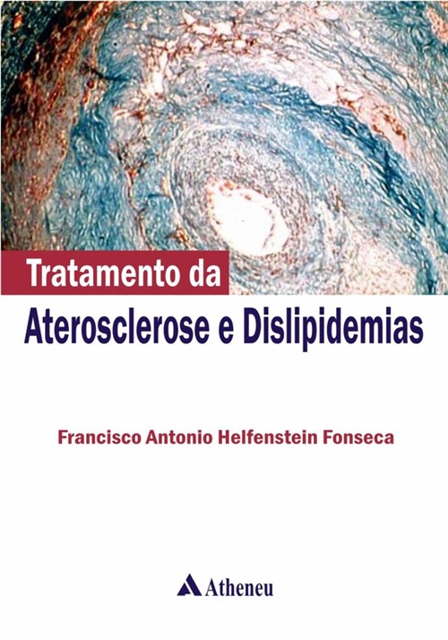 Livro - Tratamento de Ateroesclerose e Dislipidemias - Fonseca