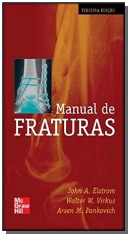 Manual de Fraturas 3 Ed.