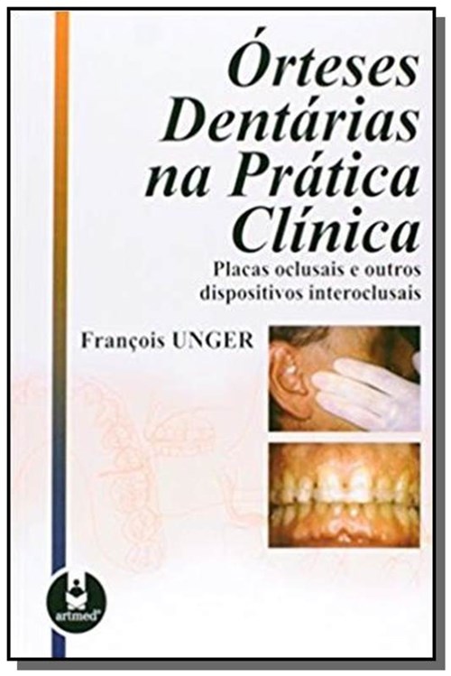 Orteses Dentarias na Pratica Clinica