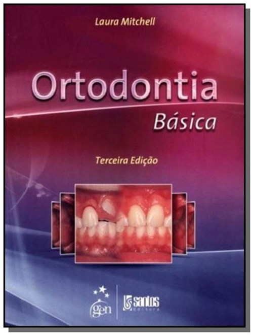 Ortodontia Basica