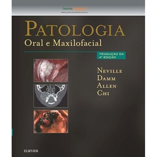 Patologia Oral e Maxilofacial - Elsevier