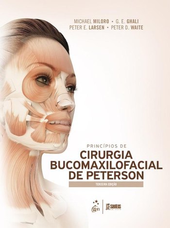 Principios de Cirurgia Bucomaxilofacial de Peterson - 3ª Ed