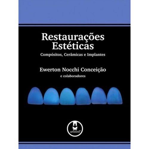 Restauracoes Esteticas - Compositos, Ceramicas e I