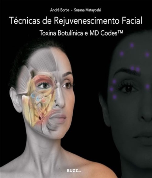 Tecnicas de Rejuvenescimento Facial - Toxina Botulinica e Md Codes