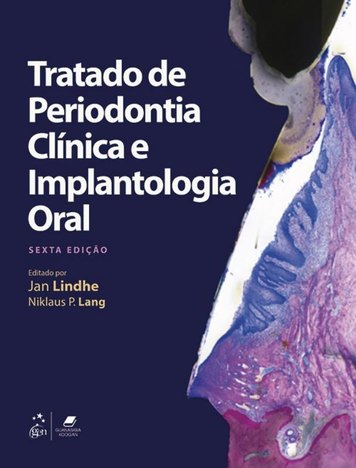 Tratado de Periodontia Clinica e Implantologia Oral - 6ª Ed