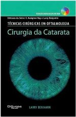 Ficha técnica e caractérísticas do produto Cirurgia da Catarata - Di Livros