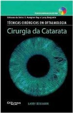 Ficha técnica e caractérísticas do produto Cirurgia da Catarata - Dilivros