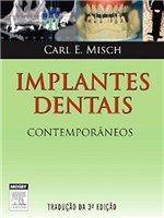 Ficha técnica e caractérísticas do produto Implantes Dentais Contemporâneos