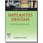 Ficha técnica e caractérísticas do produto Implantes Dentais Contemporaneos