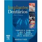 Ficha técnica e caractérísticas do produto Implantes Dentários: Arte e Ciência