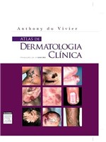 Ficha técnica e caractérísticas do produto Livro - Atlas de Dermatologia Clinica - Du Vivier - Elsevier