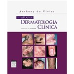 Ficha técnica e caractérísticas do produto Livro - Atlas de Dermatologia Clínica