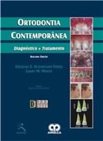 Ficha técnica e caractérísticas do produto Livro - Ortodontia Contemporânea - Diagnóstico e Tratamento - Yanez