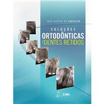 Livro - Soluções Ortodônticas para Dentes Retidos
