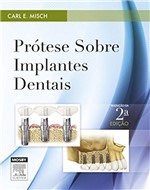Ficha técnica e caractérísticas do produto Prótese Sobre Implantes Dentais