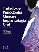Ficha técnica e caractérísticas do produto Tratado de Periodontia Clínica e Implantologia Oral